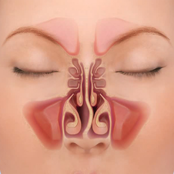 Cấu trúc xương mũi